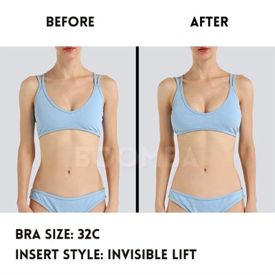 Invisible Lift Inserts